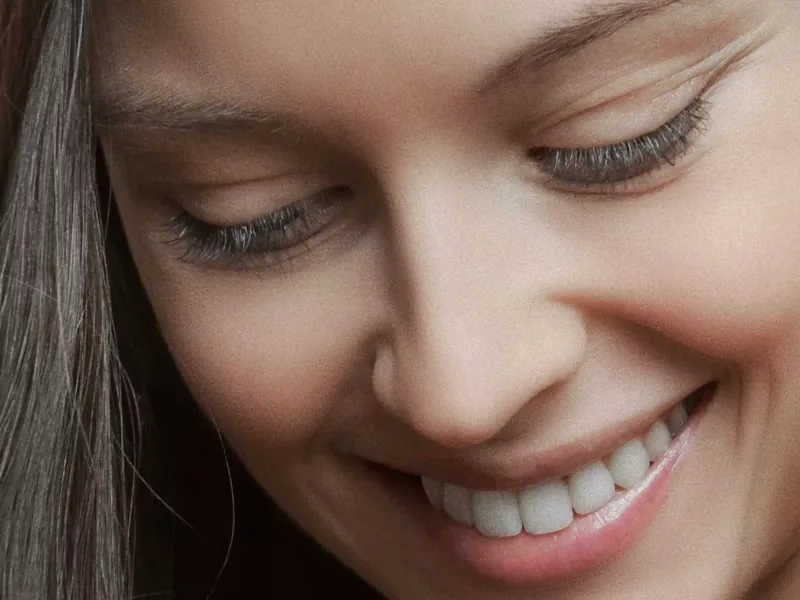 Estética facial como servicio complementario en Clínica Dental Serrería